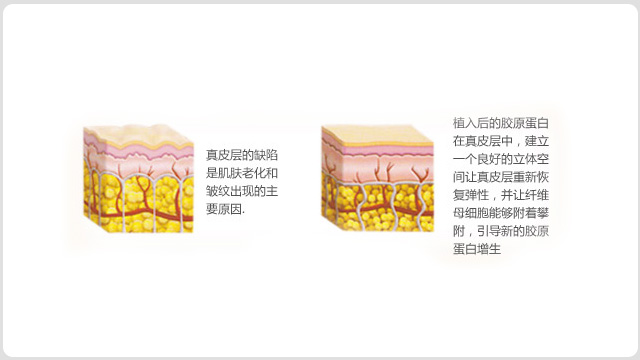 面部青春术(图12)