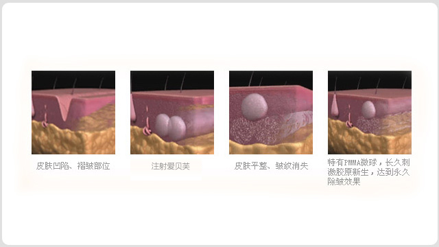 面部青春术(图9)