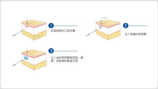 面部青春术(图11)