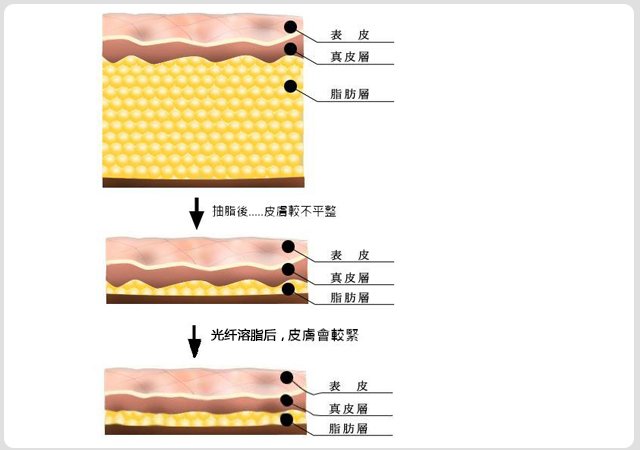 面部青春术(图16)