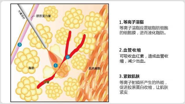 面部青春术(图17)